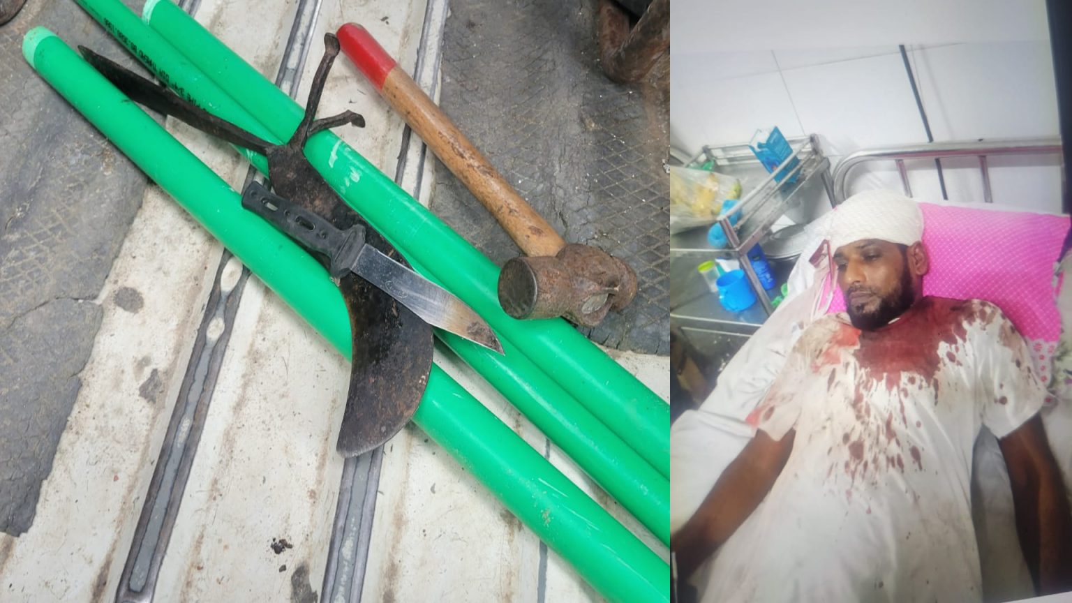 বরিশালে কাগাসুরা বাজারে গভীর রাতে জমি দখল, নারী সহ চারজনকে কুপিয়ে জখম