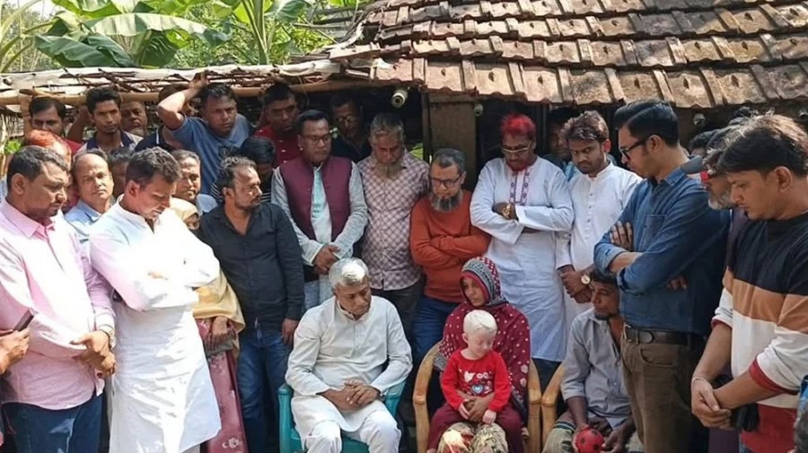 যশোরে অসহায় শিশু আফিয়ার পাশে দাঁড়ালেন তারেক রহমান