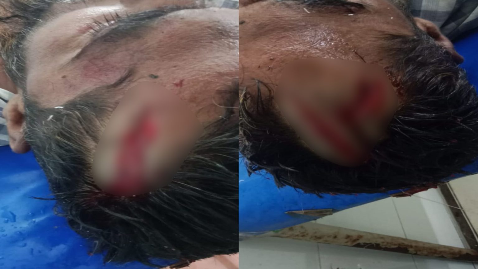ঝালকাঠির রাজাপুরে পৈতৃক সম্পত্তির বিরোধে মামাতো ভাই কর্তৃক ফুফাতো ভাইকে এলোপাতাড়ি কুপিয়ে জখম
