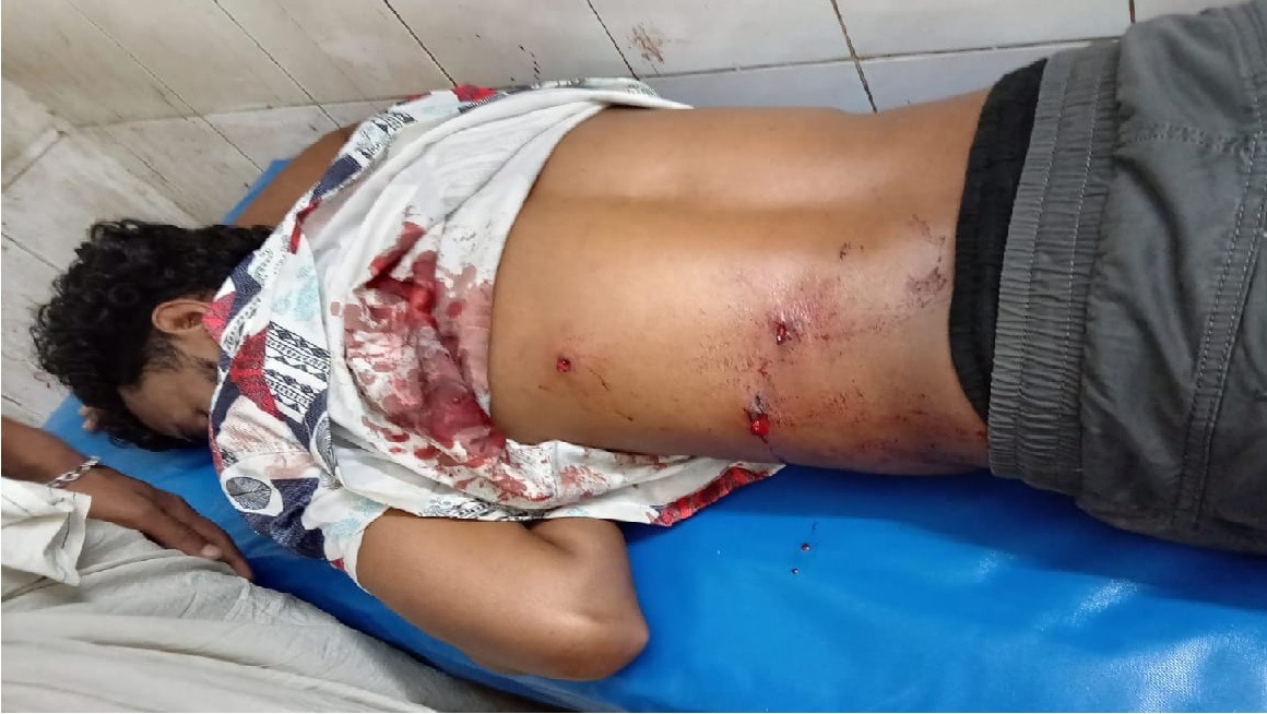 প্রতিপক্ষের গুলিতে যুবক গুরুতর আহত এলাকায় চরম আতঙ্ক