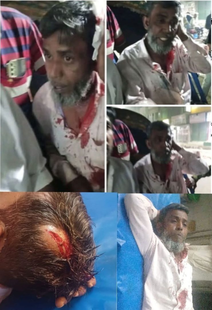 পূর্ব বিরোধের জেরে জাকিরের ওপর নৃশংস আক্রমণ, থানায় মামলা দায়ের