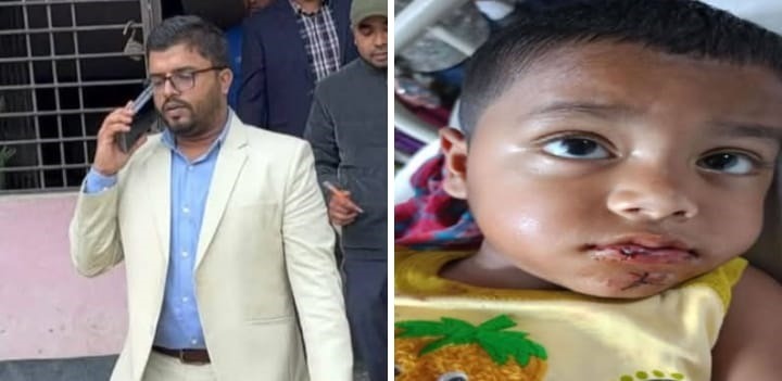 ইউএনও’র সরকারি গাড়ীর সাথে অটোভ্যানের ধাক্কা লেগে শিশু আহত, চিকিৎসার দায়িত্ব নিলেন ইউএনও