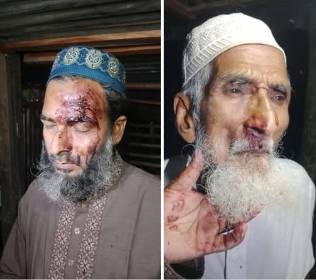 বানারীপাড়ায় রাজুর বিরুদ্ধে চাঁদাবাজি-সন্ত্রাসের অভিযোগ, হামলার শিকার বাবা ছেলে