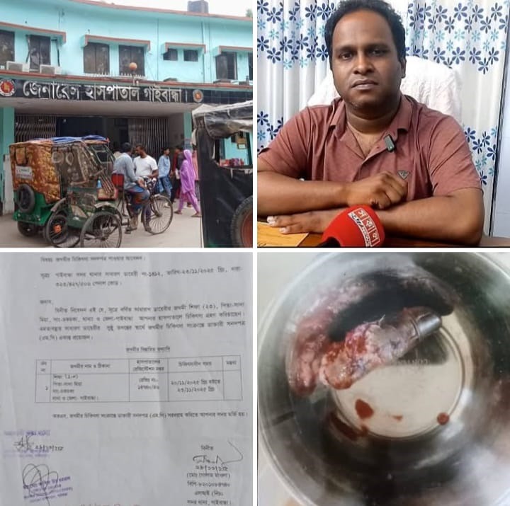গাইবান্ধা জেনারেল হাসপাতালের আরএমও-র বিরুদ্ধে সংবাদ প্রচারের নেপথ্যে ‘স্বার্থান্বেষী মহল’, নিরপেক্ষ তদন্তের দাবি