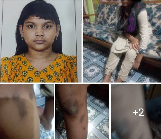 ডাক্তার দম্পতির হাতে গৃহকর্মী নির্যাতনের অভিযোগ, উদ্ধার করল পুলিশ !!