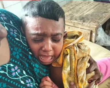 যশোর শহরতলীর ধর্মতলা এলাকায় বোমা সদৃশ বস্তু বিস্ফোরণে দুই শিশু আহত