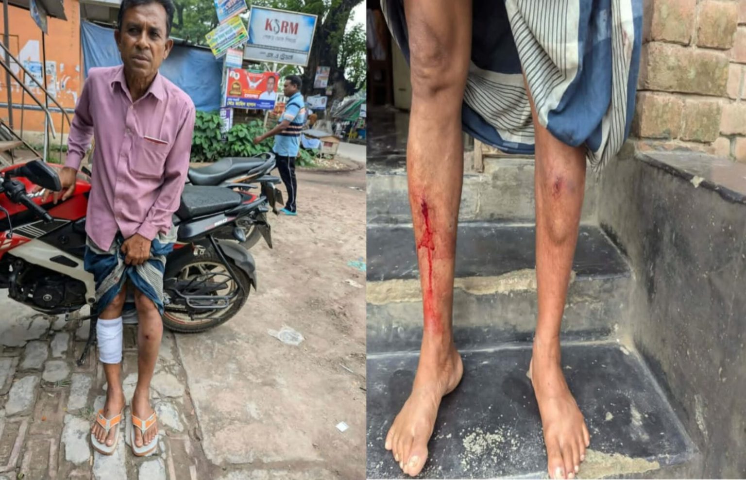 ঝিনাইদহে চাঁদা না পেয়ে পূজা উদযাপন পরিষদের নেতাকে কুপিয়ে জখম, থানায় অভিযোগ