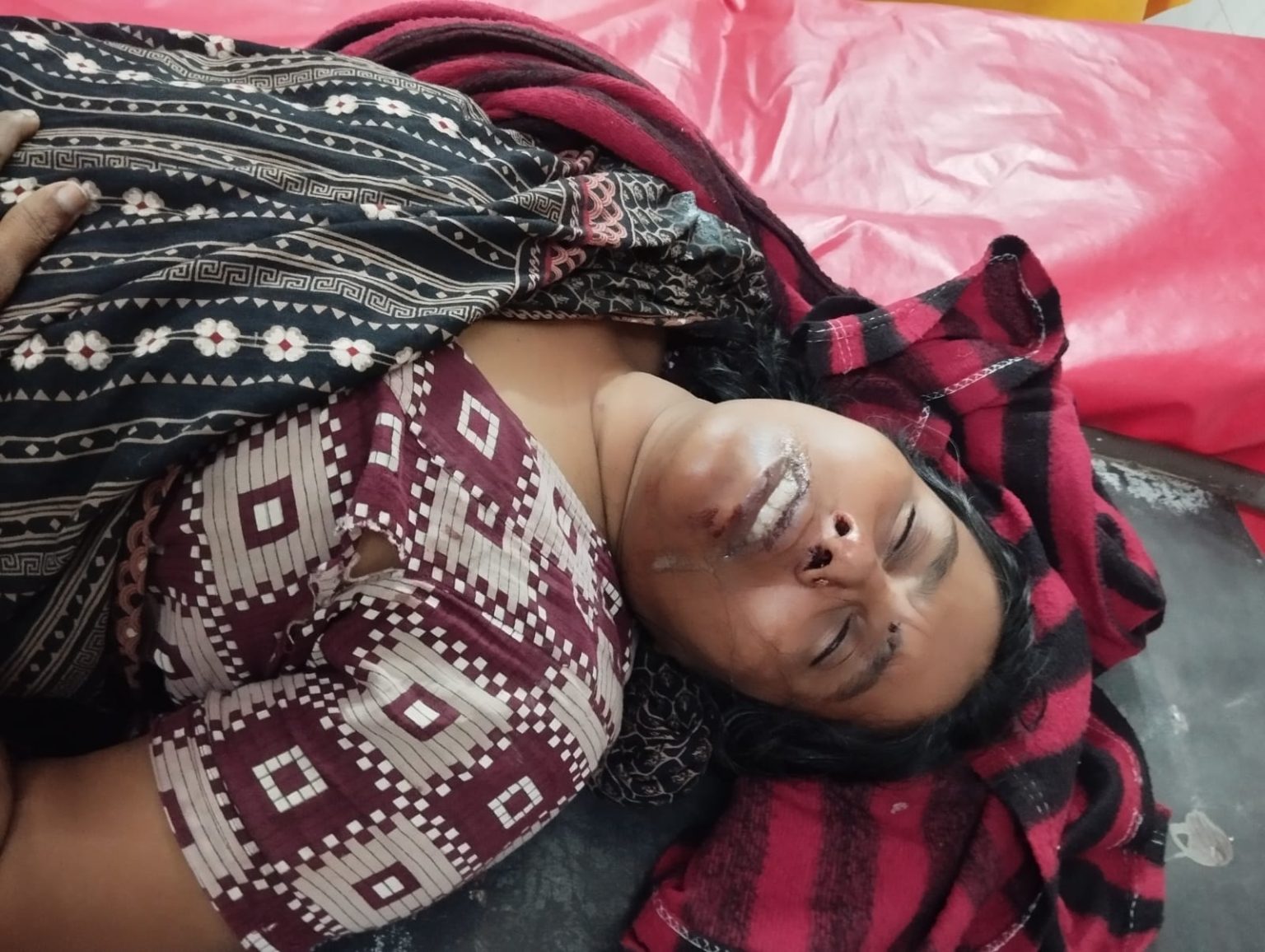 কমলনগর মাতাব্বর হাট বাজারে দোকান ঘর নিয়ে দুই ভাইয়ের স্ত্রীর মারামারি, গুরুতর আহত মারজান বেগম