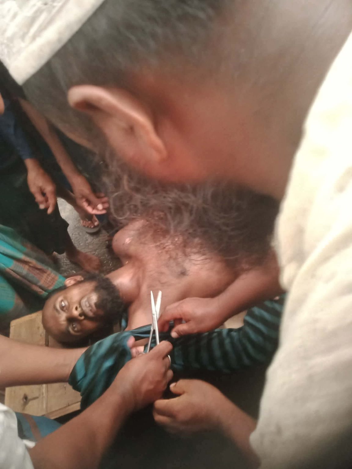 বকশীগঞ্জে বজ্রপাতে বাবা-ছেলে গুরুতর আহত