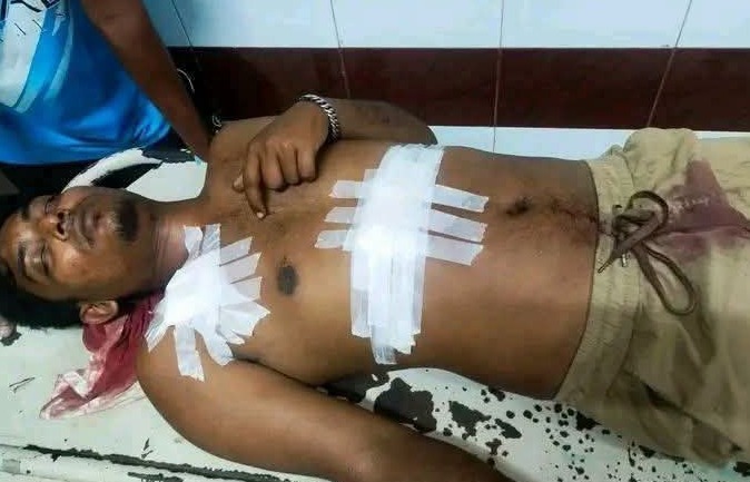মেলায় তরুণীর উত্ত্যক্তের প্রতিবাদ করায় যুবককে ছুরিকাঘাত
