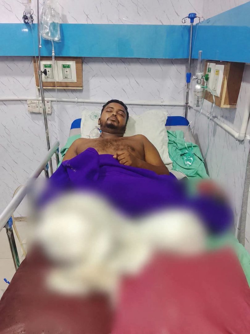 রিকশা চালিয়ে চলত সংসার, সড়ক দুর্ঘটনায় হারালেন, দুই পা এখন অনিশ্চিত জীবন বাঁচতে সবার সহযোগিতা চান অনিক