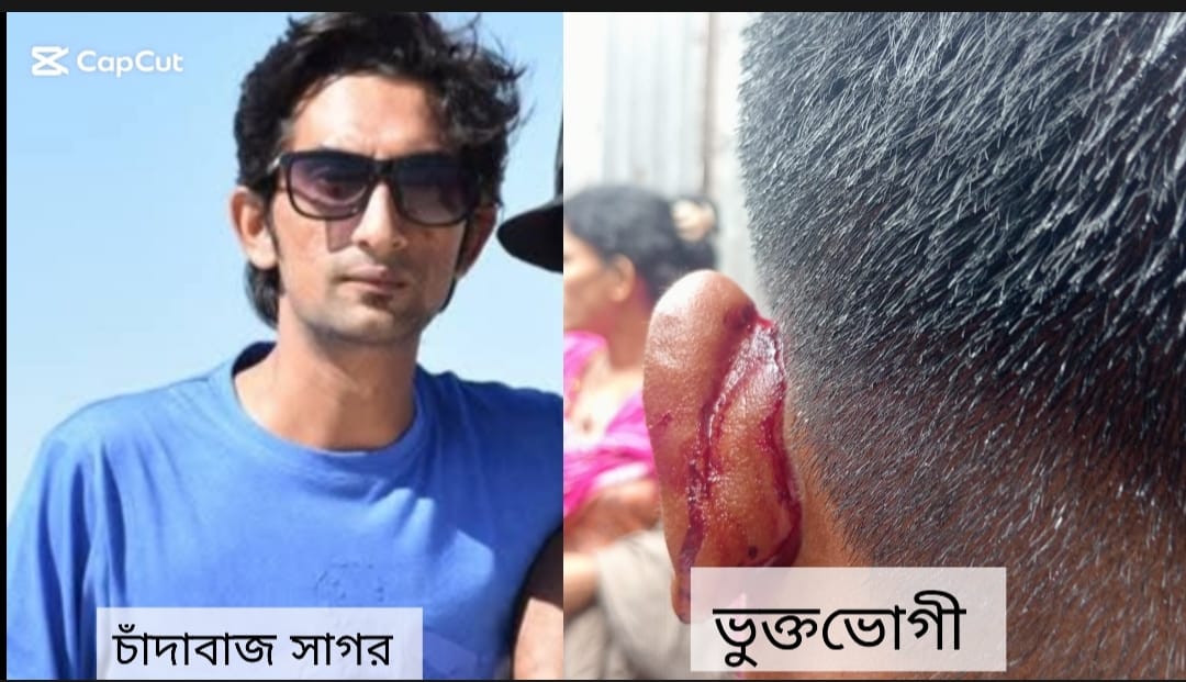 কালিয়াকৈরে চাঁদার দাবিতে হামলার অভিযোগ, আহত ব্যবসায়ী