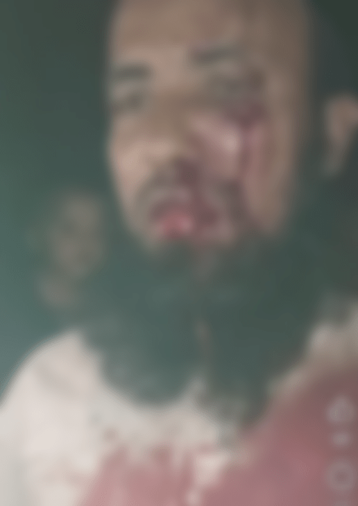 নবীনগরে জুমার নামাজ পড়ানোর জেরে মসজিদের ইমাম ও ভাইকে পিটিয়ে জখম
